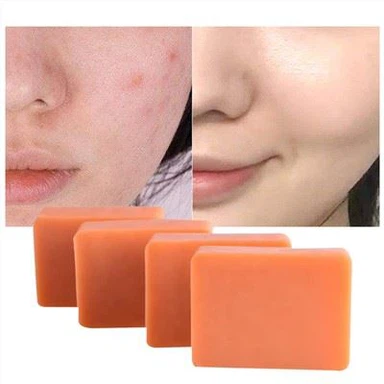 Sabun Batang Pembersih Asam Kojic